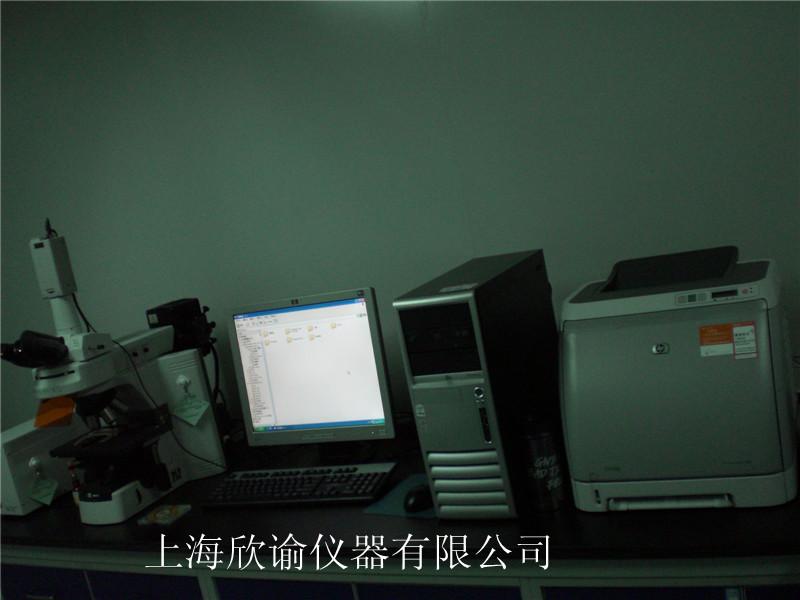 [欄目置頂]染色體分析系統(tǒng)（XY-RS-A2）、高配核型分析系統(tǒng)
